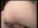 Anal