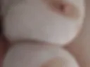 breast