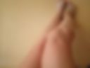 Legs