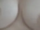 Chest 1