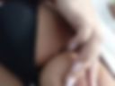 Nipples