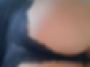 Buttocks