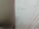 pubic hair