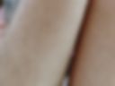 Clitoris