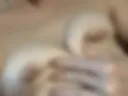 Breast