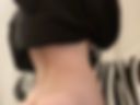 18)