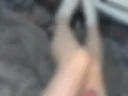 legs
