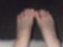 Legs