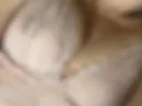 Breast