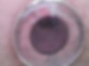 18+