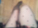 Legs 2