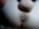 Anus