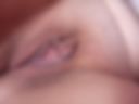 Breast, surprise