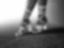 Legs