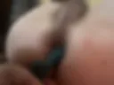 Anal