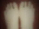 foot  and aheago