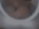 Breast