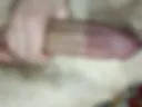 Penis