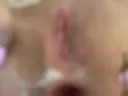 After anal