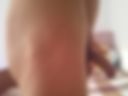 Hot me