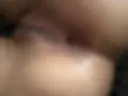 A butthole