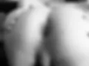 Anal 1