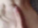 Penis