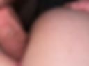 Anal