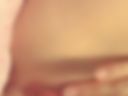 hairless