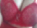 Breast