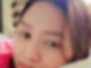 Teaser4