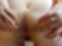 Anal