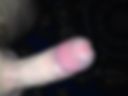 Penis