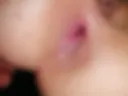 Anal