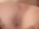 Anal