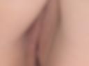My holes