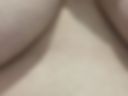 Natural breasts