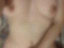 Breast