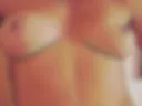 18+ @2