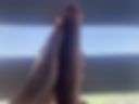 Anal