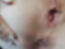holes