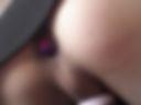 Anal
