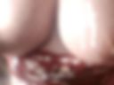 breast