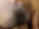 Breast