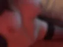 Breast