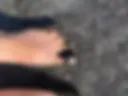 Legs