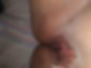 MI VAGINITA