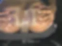 All Ass
