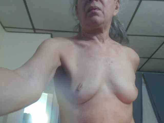 FIXMYASSTOO webcam