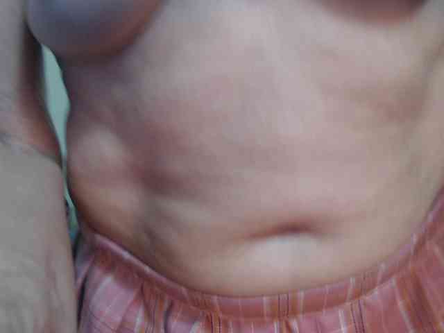 Modelo: FIXMYASSTOO